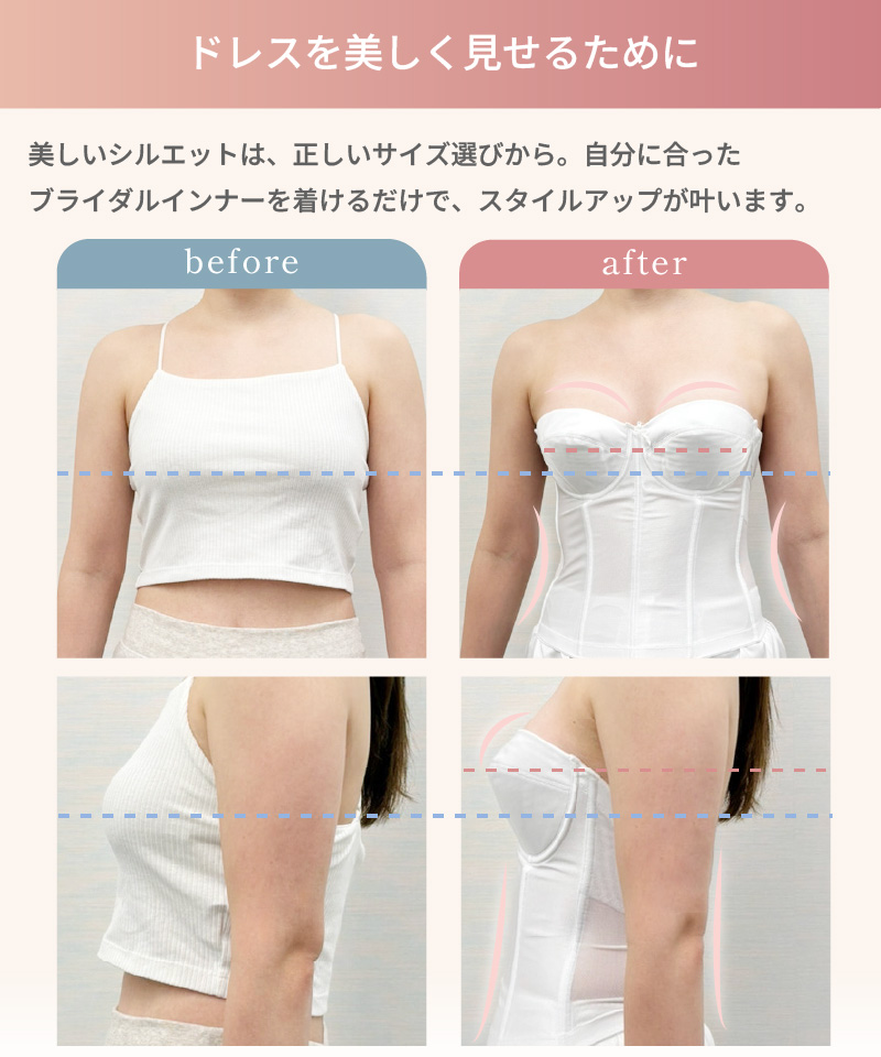 ドレスを美しく見せるために｜ブライダルインナー着用ビフォーアフター比較